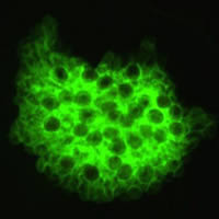 Pneumocystis_IFA_B.jpg