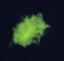 Pneumocystis_IF_DPDx.jpg