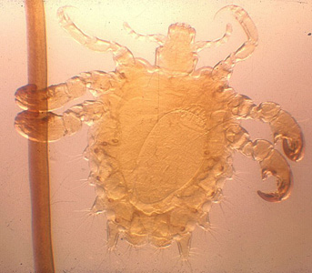 Phthirus_pubis_female.jpg
