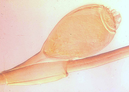 Phthirus_pubis_egg.jpg