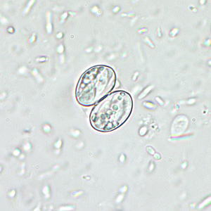 Sarcocystis_wtmt_400x2.jpg