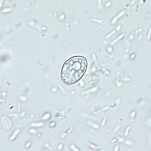 Sarcocystis_wtmt_400x4.jpg