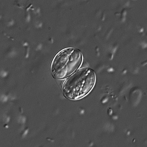 Sarcocystis_DIC2_400x.jpg