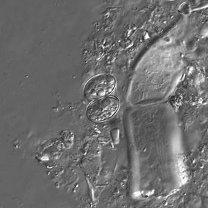 Sarcocystis_DIC3_400x.jpg