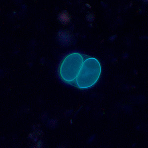 Sarcocystis_UV1_400x.jpg