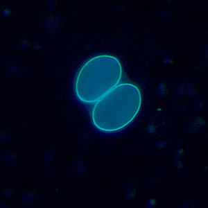 Sarcocystis_UV2_400x.jpg