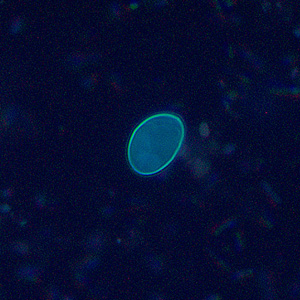 Sarcocystis_UV3_400x.jpg