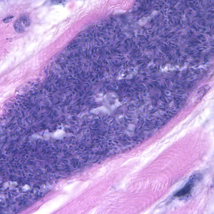 Sarcocystis_1000x1_muscle.jpg