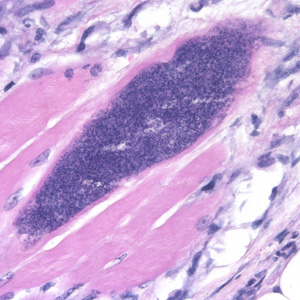 Sarcocystis_500x1_muscle.jpg