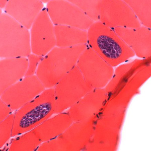 Sarcocystis_muscle_HE_MI.jpg