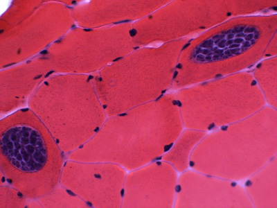 Sarcocystis_muscle_HE_MI_2_rotated.jpg