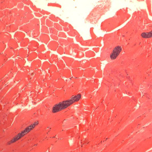 Sarcocystis_muscle_HE_MI_3.jpg