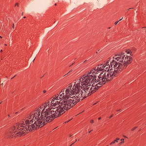 Sarcocystis_muscle_HE_MI_4.jpg