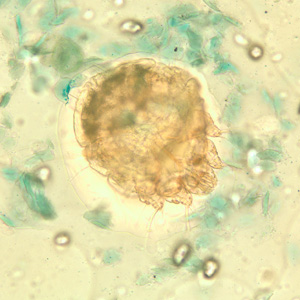 Sarcoptes_scabiei_BAM2.jpg