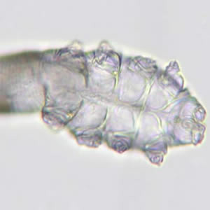 Demodex_Vidhya_anterior_A.jpg