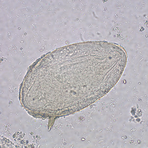 S_mansoni_egg_MO1.jpg