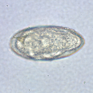 S_mansoni_egg_MO2.jpg