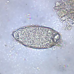 S_mansoni_egg_WI1.jpg