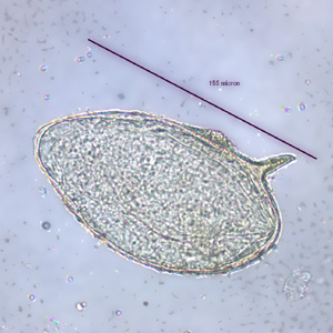 S_mansoni_egg_WI2.jpg