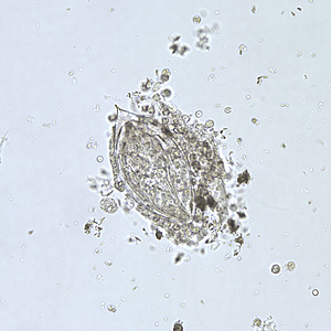 S_haematobium_egg_HB1.jpg