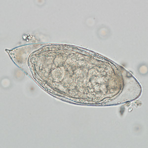 S_haematobium_egg_HB2.jpg