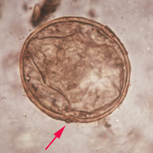 S_japonicum_egg_2X2a.jpg