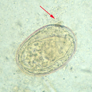 S_japonicum_egg_2X2b.jpg