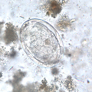 S_japonicum_egg_BAM1.jpg