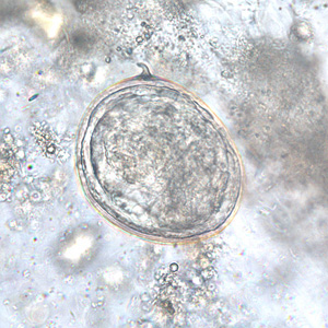 S_japonicum_egg_BAM2.jpg