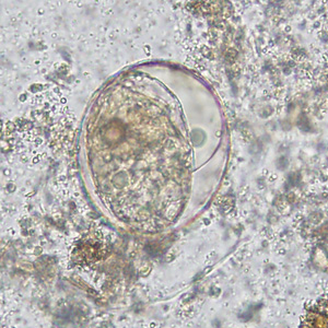 S_japonicum_egg_wtmt_HBa.jpg