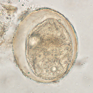 S_japonicum_egg_wtmt_HBb.jpg