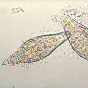 S_intercalatum_WHO_HB.jpg