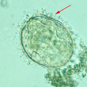 S_mekongi_egg_2X2a.jpg
