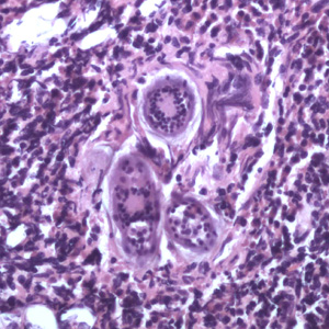 S_haematobium_eggs_tissue_HoustonVA1.jpg