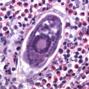 S_haematobium_eggs_tissue_HoustonVA2.jpg
