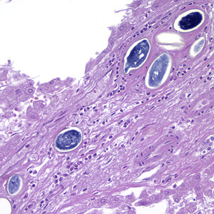 S_japonicum_egg_200x_HE_HB1.jpg