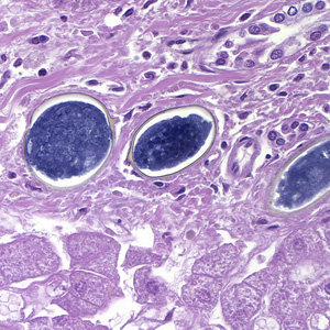 S_japonicum_egg_400x_HE_HB1.jpg