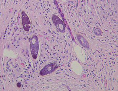 S_mansoni_eggs_tissue_Desai1.jpg