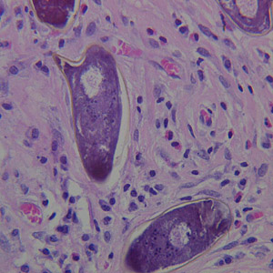 S_mansoni_eggs_tissue_Desai2.jpg