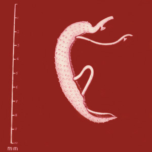 S_mansoni_adult_Lammie2.jpg