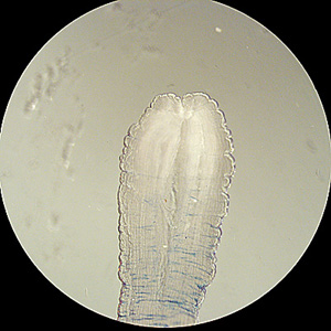 Sparganum_OK_C.jpg