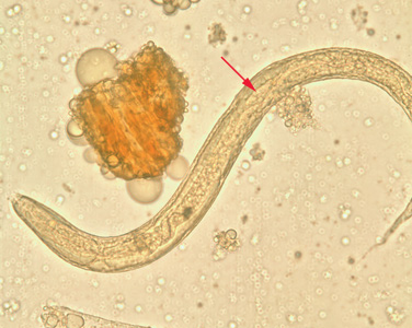 S_stercoralis_rhabditoid_BAM1.jpg Figure B