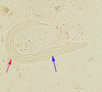 S_stercoralis_rhabditoid_BAM10.jpg Figure E