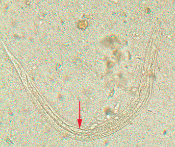 S_stercoralis_rhabditoid_BAM7.jpg Figure D