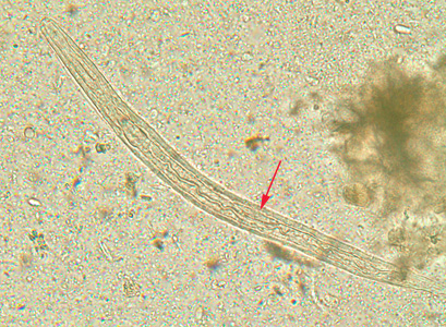 S_stercoralis_rhabditoid_BAM8.jpg Figure A