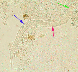 S_stercoralis_rhabditoid_BAM9.jpg Figure F