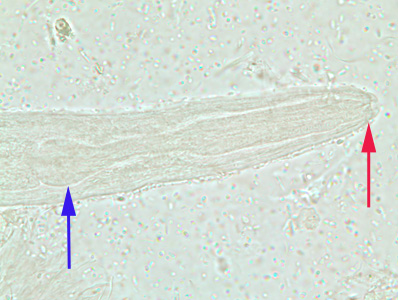 S_stercoralis_rhabditoid_anterior_BAM1.jpg Figure C