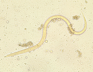 S_stercoralis_filariform_BAM1.jpg