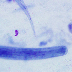 S_stercoralis_filariform_HB2.jpg Figure C