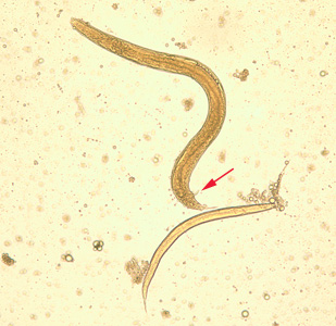 S_stercoralis_adult_larva_BAM1.jpg